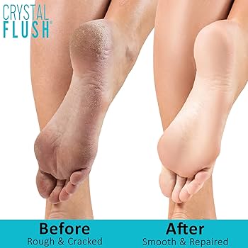 soak feet in apple cider vinegar